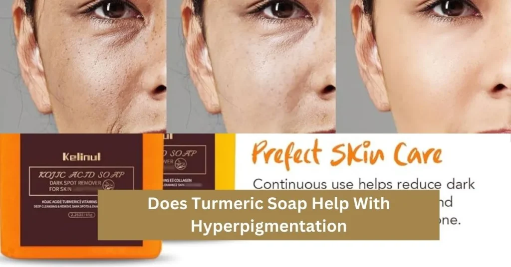 Does Turmeric Soap Help With Hyperpigmentation