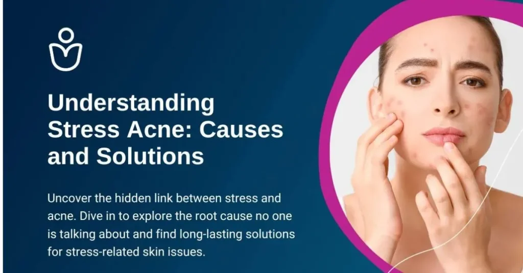 Can Stress Cause Acne Breakout