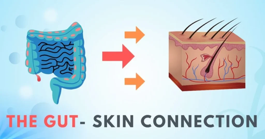 The Gut-Skin Connection