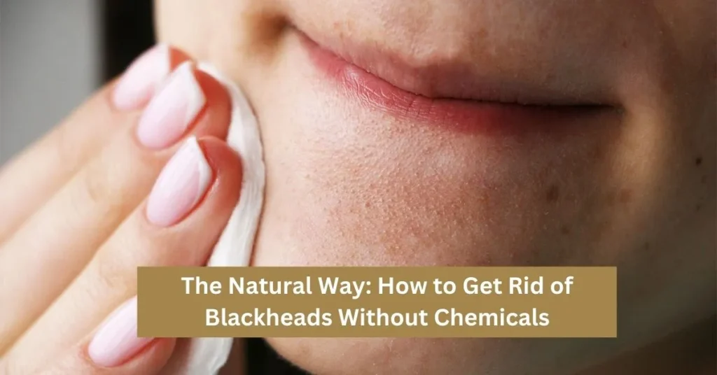 The Natural Way How to Get Rid of Blackheads Without Chemicals