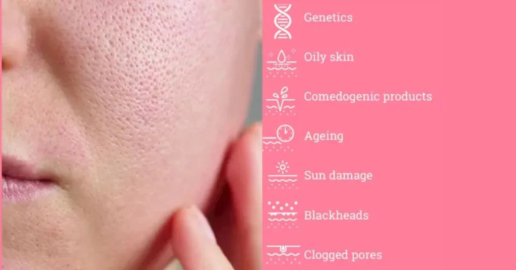 What Causes Large Pores on Your Face?