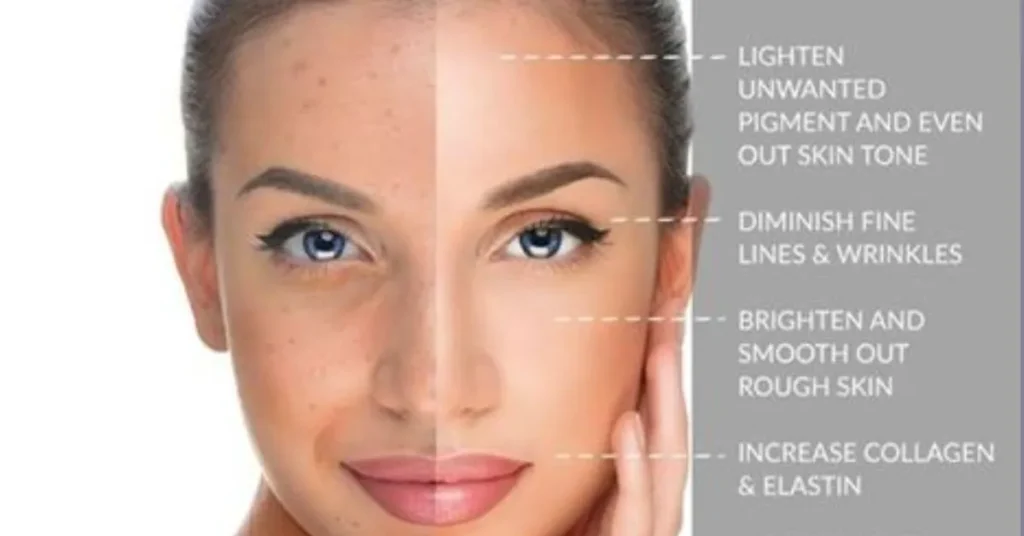  Benefits of Chemical Peels 